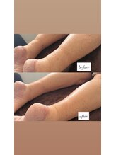 ラディア ボディ(Radia Body)/重みのあるハンド技術