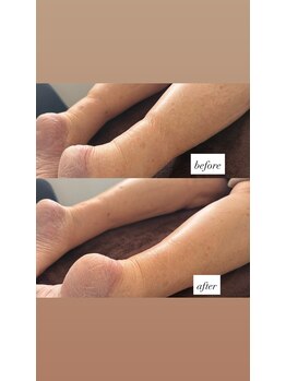 ラディア ボディ(Radia Body)/重みのあるハンド技術