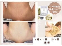 ムーロ バイ ミュー(muro. by mieux)の雰囲気（背中のニキビケアに大人気！ブライダルにも◎）