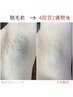 【水・金・土ご来店限定】ワキ脱毛 3回券