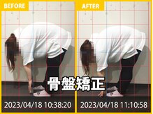 整体院 元 宇城松橋店/慢性腰痛が改善！