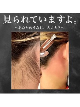 エヌティー 時津店(N T)/WAX脱毛