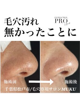 ムク(MUKU)/90分で変わります