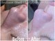 ブリリアント シェル(Brilliant Shell)の写真