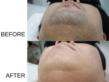 アニュ(a nu)/選択できるメニューや支払い方法