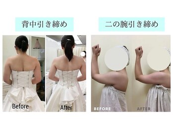 ウィズマツオカ 光の森店/脂肪撃退ダイエットマシーン