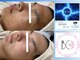 トータルサロンアイビーシー(トータルサロンIBC)の写真/他店でどうにも改善出来なかった『ニキビ、毛穴、ゴワつき、たるみ、乾燥、くすみ』でお悩みの方へ！
