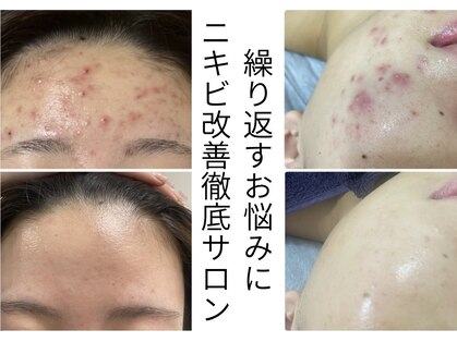 アリュール 京都烏丸御池店(ALLURE)の写真