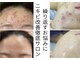 アリュール 京都烏丸御池店(ALLURE)の写真