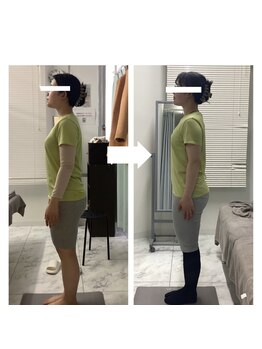 シンメトリー 千葉店/立ち姿まで変わる♪