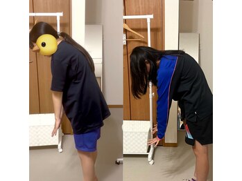 ノエ(Noe)/腰痛改善