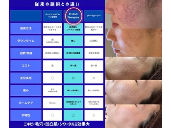 ザ ベッピン(the 別嬪)/アメリカ発！肌改善メニュー