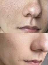 イニジアエリート 池袋店(inizia elite)/