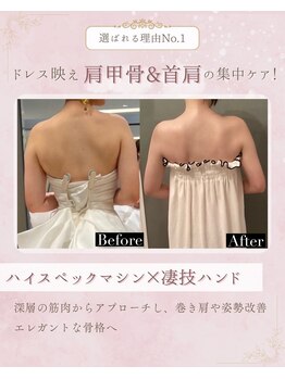 ラトナ(Ratna)の写真/自分史上最高に美しく＼華奢／に!【華奢二の腕/肩甲骨出し】花嫁様仕上げ圧倒的症例数【本気の身体改革】