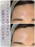 【導入キャンペーン】マリムーブフェイシャルワックス☆¥9000→¥7000