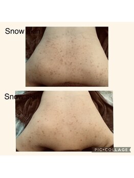 スノースキン(Snow skin)/【ブライダルの方集合～】