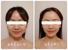 ホワイトサロンファミリア(whitesalon familia)/小顔コルギ＋毛穴洗浄＋美容液