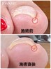 【巻爪ケア初回限定】韓国特許取得技法巻爪ケア+フットジェル¥16600→¥14950