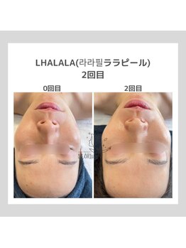 ポムハヌル 大阪梅田中崎町(pom.haneul)/韓国肌管理室