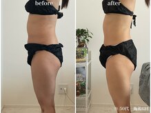 ウル(Ulu)/腸もみビフォーアフター