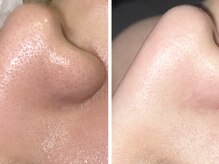 クリアー(CLEAR.)/【Before＆After】