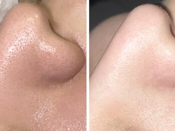 クリアー(CLEAR.)/【Before＆After】