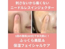 モアビューティーエステ 本通り店(MORE BEAUTY ESTHE)の雰囲気（45分でしっかり結果もご覧いただけます＾＾）
