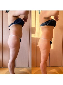 凪 横浜/スリムアトラクション１回結果