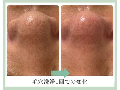 ルーセントの写真