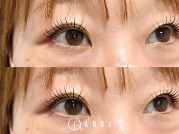 アンネ 伊丹店(ANNE)/【エクパーマ】