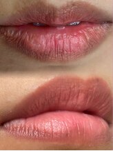 アンフィア(Anfia)/