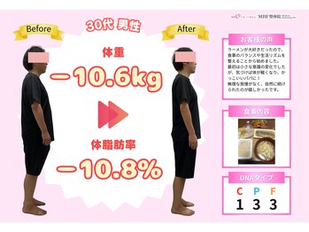 MBF整体院 矢板院/男性でもスッキリ変化