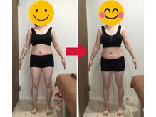 美容整体院元 光の森店/20代N.M様のビフォーアフター