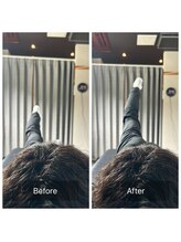 NAORU整体　博多院【肩こり・腰痛・猫背・骨盤・姿勢矯正】/Before After【股関節伸展】