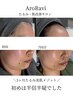 【限定4名様】脱たるみ・美肌小顔3か月プログラムで褒められ肌へ♪