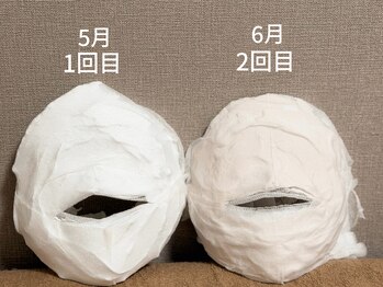ルアナ(Luana)/1ヶ月の変化 小顔ヘッドスパ