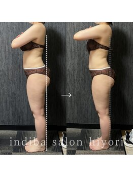 ヒヨリ(hiyori)/《before/after》反り腰改善