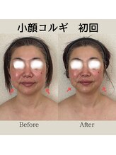 リーブル(LIBRE)/小顔コルギ　初回