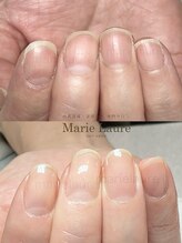 マリーロール 淀屋橋本店(Marie Laure)/自爪育成/深爪矯正/ネイルケア