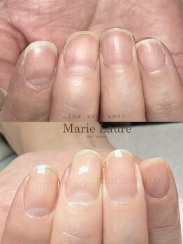 マリーロール 淀屋橋本店(Marie Laure)/自爪育成/深爪矯正/ネイルケア
