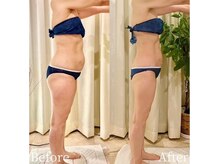 ミスティア(mistia)/エステ 全身10回