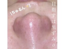 ミラーヴ(MERAVE)/憧れの毛穴レスになれる♪