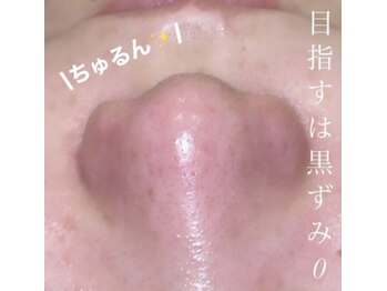 ミラーヴ(MERAVE)/憧れの毛穴レスになれる♪