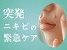 【突発ニキビの緊急ケア！】全顔ハーブピーリング+プラズマ（剥離なし）
