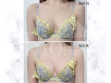 サロン アンネ(Anne)/本格エステ豊胸プログラム