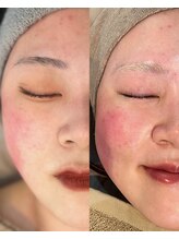 ミーエイト(Mii∞)/《プラズマパールリフトフォト》