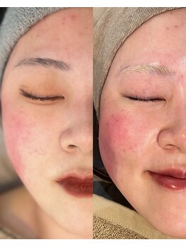 ミーエイト(Mii∞)/《プラズマパールリフトフォト》