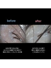 マナワ(manawa)/ヘッドスパ施術 before→after