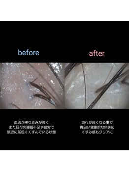 マナワ(manawa)/ヘッドスパ施術 before→after