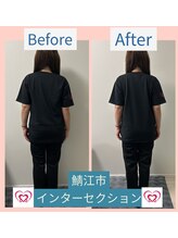 腰の整体インターセクション/美容整体【歪み改善】